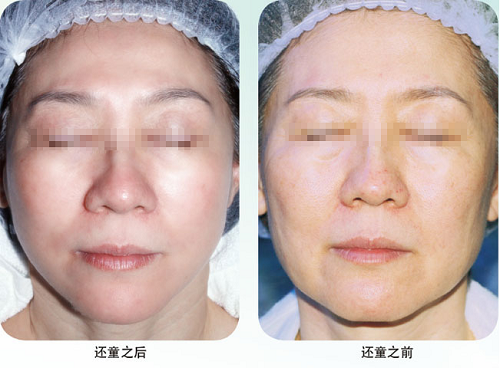 k8凯发官网(中国)天生赢家·一触即发