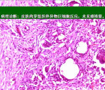 k8凯发官网(中国)天生赢家·一触即发
