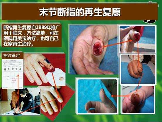 k8凯发官网(中国)天生赢家·一触即发