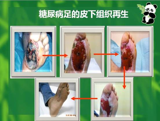 k8凯发官网(中国)天生赢家·一触即发