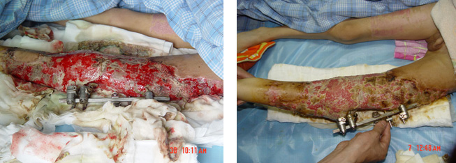 k8凯发官网(中国)天生赢家·一触即发