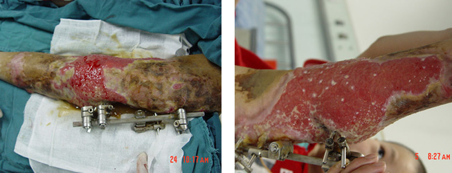 k8凯发官网(中国)天生赢家·一触即发