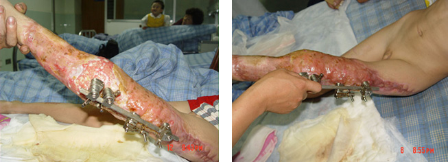 k8凯发官网(中国)天生赢家·一触即发