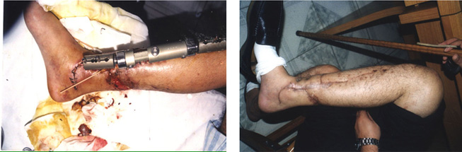 k8凯发官网(中国)天生赢家·一触即发