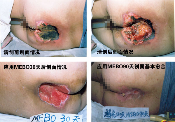 k8凯发官网(中国)天生赢家·一触即发