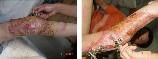 k8凯发官网(中国)天生赢家·一触即发