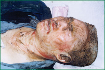 k8凯发官网(中国)天生赢家·一触即发