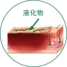 k8凯发官网(中国)天生赢家·一触即发