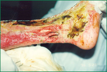 k8凯发官网(中国)天生赢家·一触即发