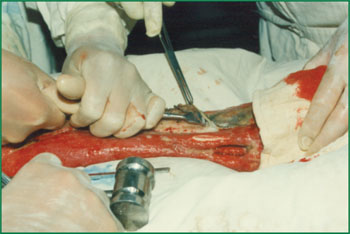 k8凯发官网(中国)天生赢家·一触即发