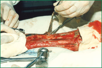 k8凯发官网(中国)天生赢家·一触即发