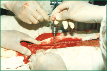 k8凯发官网(中国)天生赢家·一触即发