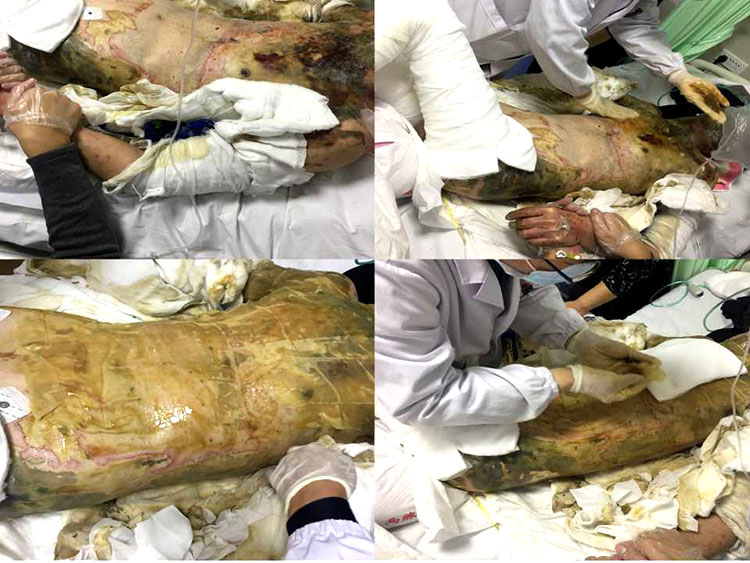 k8凯发官网(中国)天生赢家·一触即发