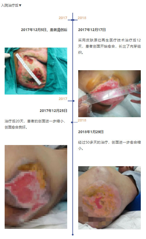 k8凯发官网(中国)天生赢家·一触即发