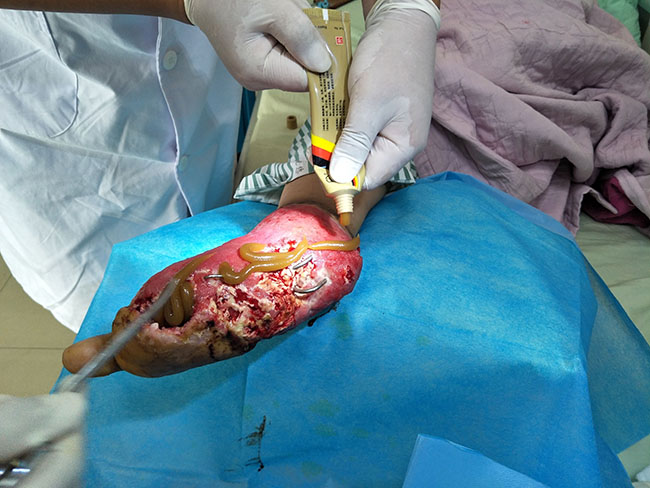 k8凯发官网(中国)天生赢家·一触即发