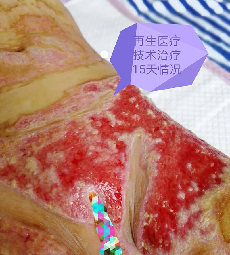 k8凯发官网(中国)天生赢家·一触即发