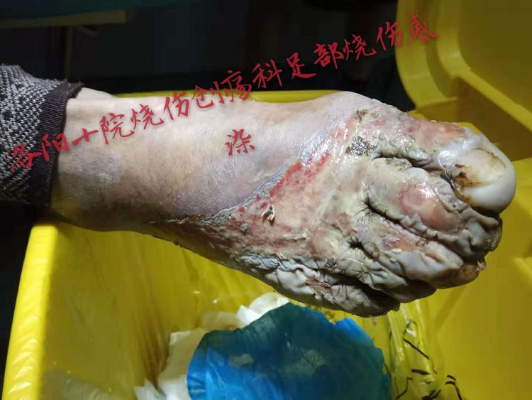 k8凯发官网(中国)天生赢家·一触即发