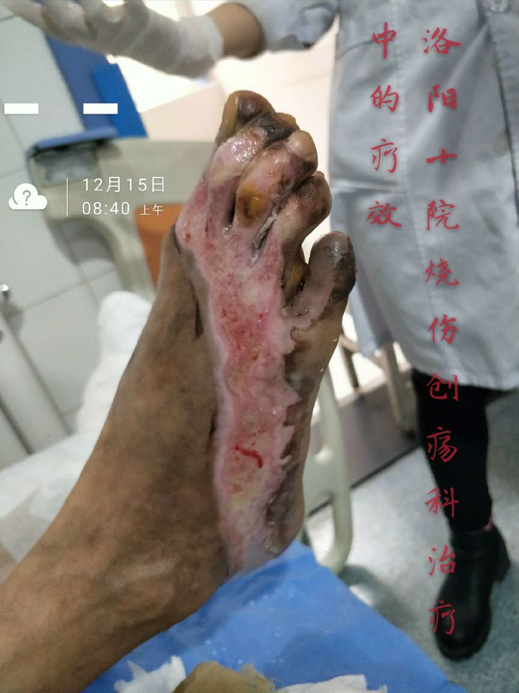 k8凯发官网(中国)天生赢家·一触即发