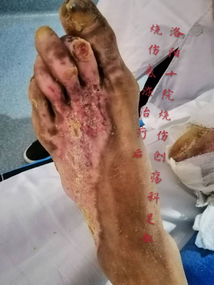 k8凯发官网(中国)天生赢家·一触即发