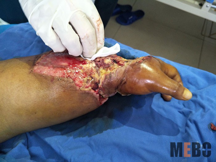 k8凯发官网(中国)天生赢家·一触即发