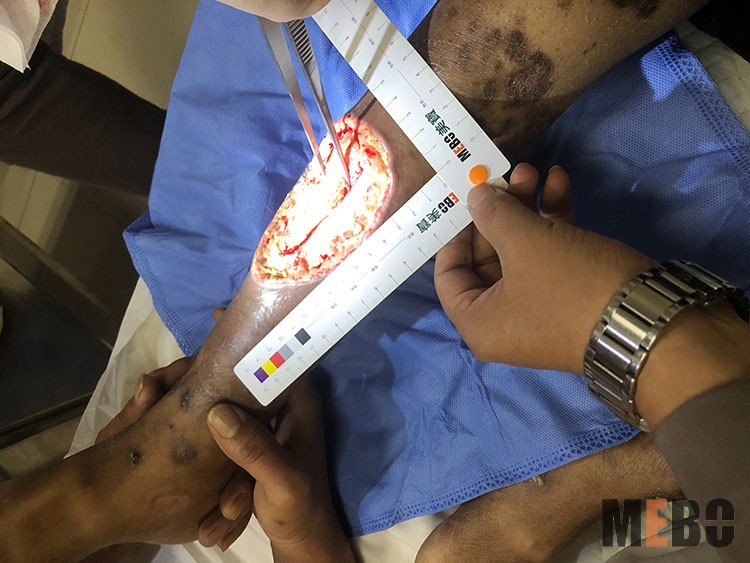 k8凯发官网(中国)天生赢家·一触即发