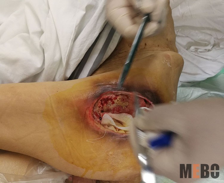 k8凯发官网(中国)天生赢家·一触即发