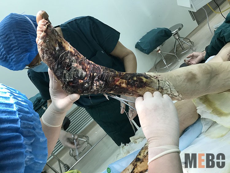 k8凯发官网(中国)天生赢家·一触即发