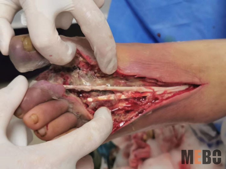 k8凯发官网(中国)天生赢家·一触即发