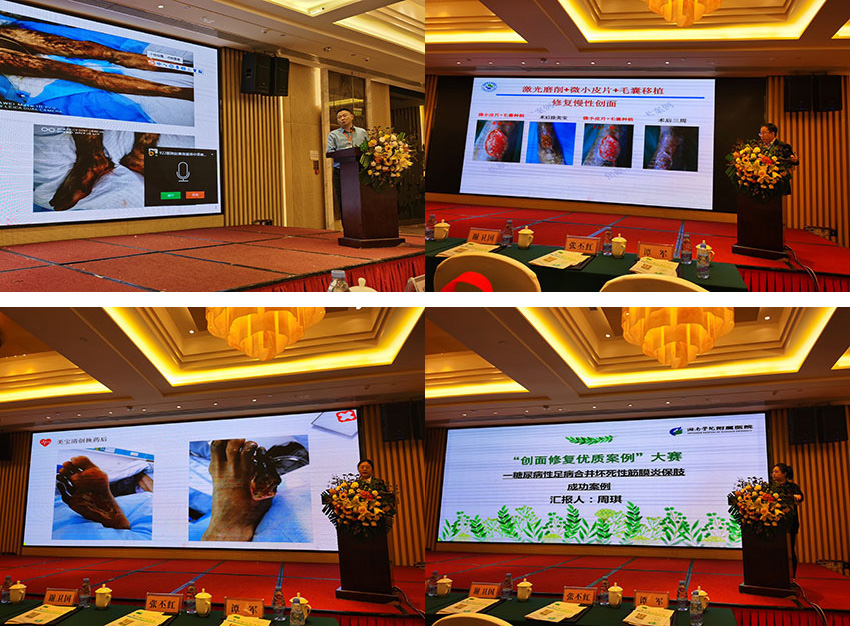 k8凯发官网(中国)天生赢家·一触即发