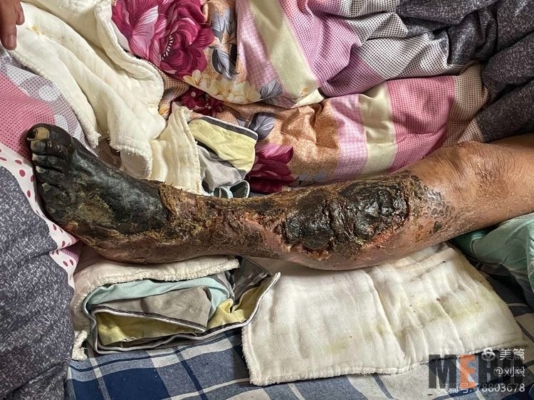 k8凯发官网(中国)天生赢家·一触即发