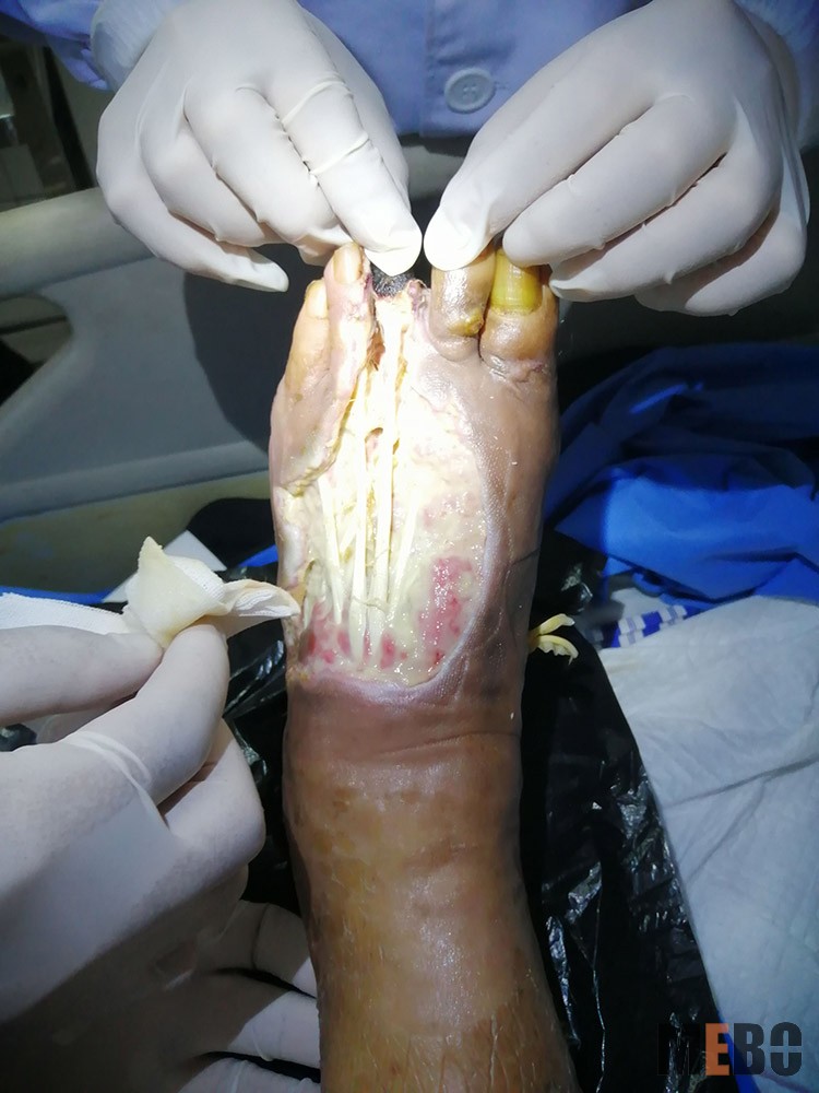 k8凯发官网(中国)天生赢家·一触即发