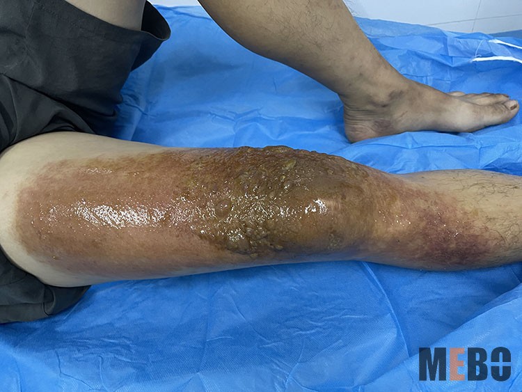 k8凯发官网(中国)天生赢家·一触即发