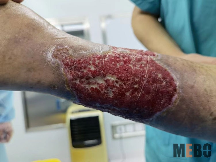 k8凯发官网(中国)天生赢家·一触即发