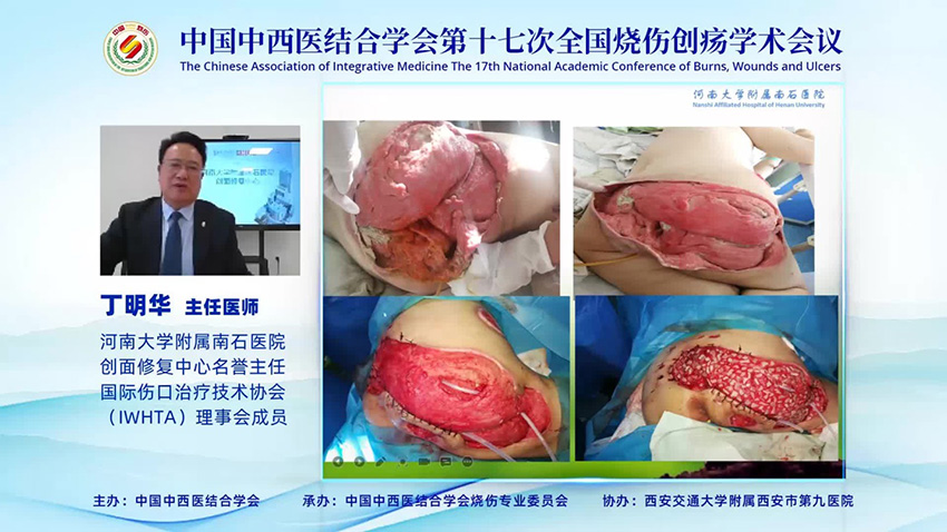 k8凯发官网(中国)天生赢家·一触即发