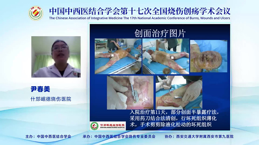 k8凯发官网(中国)天生赢家·一触即发