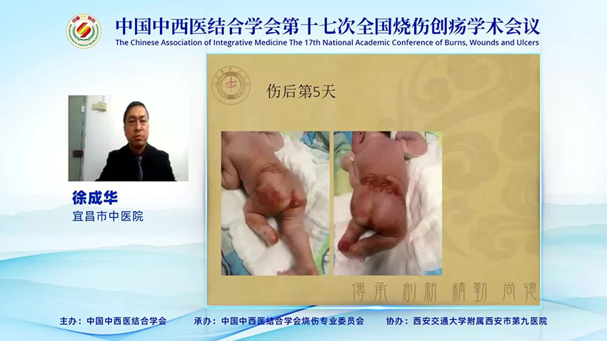 k8凯发官网(中国)天生赢家·一触即发