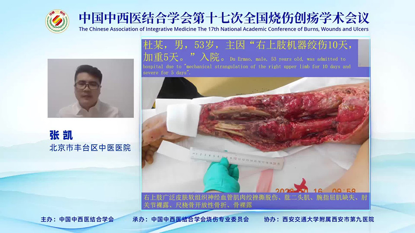 k8凯发官网(中国)天生赢家·一触即发