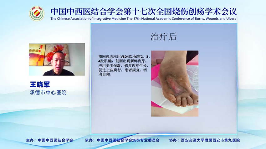 k8凯发官网(中国)天生赢家·一触即发