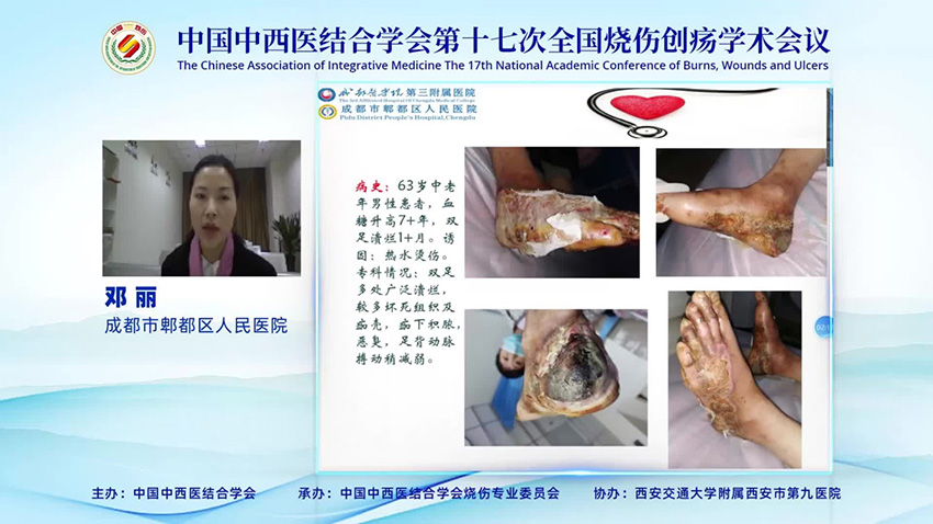 k8凯发官网(中国)天生赢家·一触即发