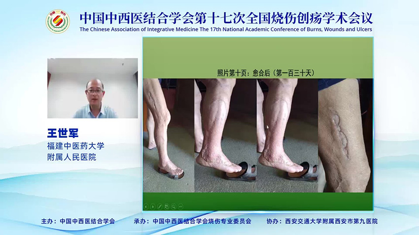 k8凯发官网(中国)天生赢家·一触即发