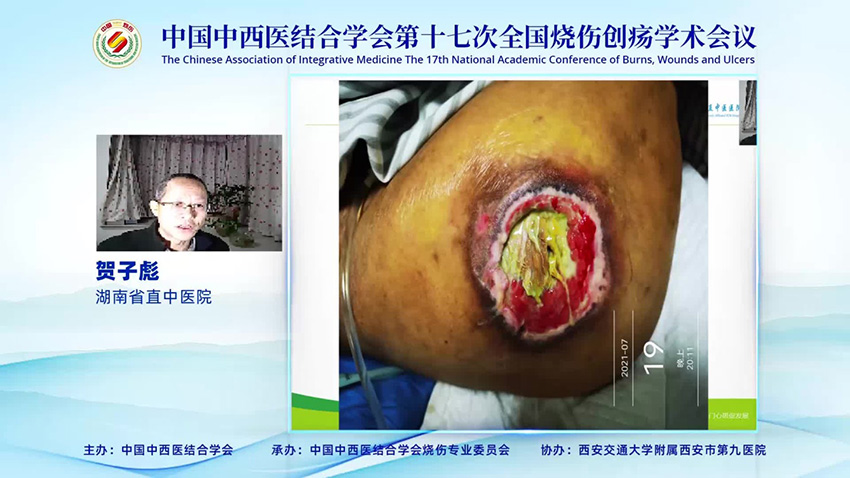 k8凯发官网(中国)天生赢家·一触即发