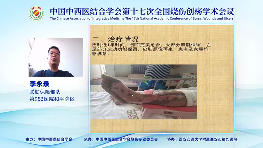 k8凯发官网(中国)天生赢家·一触即发