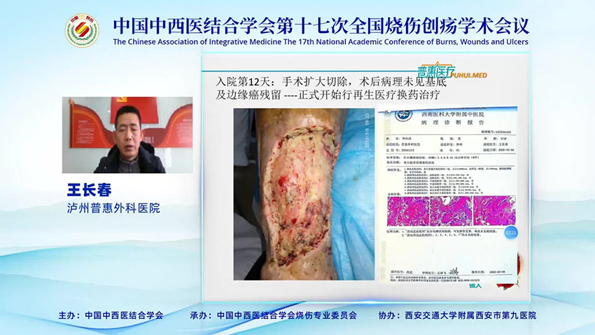 k8凯发官网(中国)天生赢家·一触即发