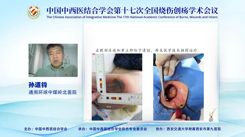 k8凯发官网(中国)天生赢家·一触即发