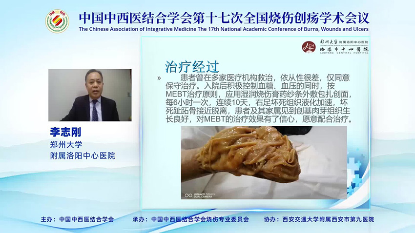 k8凯发官网(中国)天生赢家·一触即发