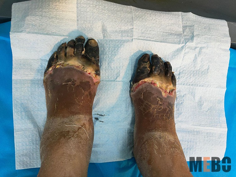 k8凯发官网(中国)天生赢家·一触即发