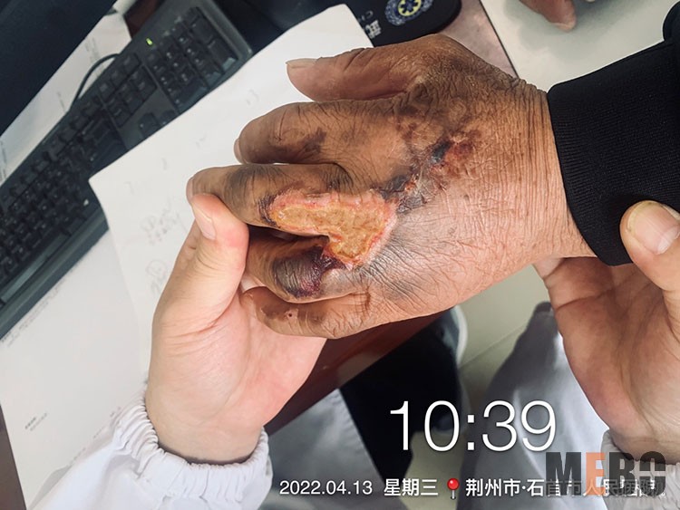 k8凯发官网(中国)天生赢家·一触即发