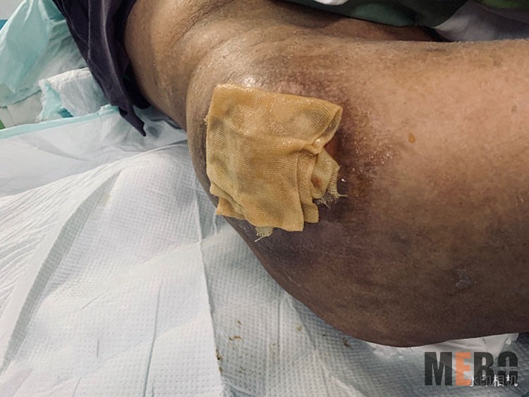 k8凯发官网(中国)天生赢家·一触即发