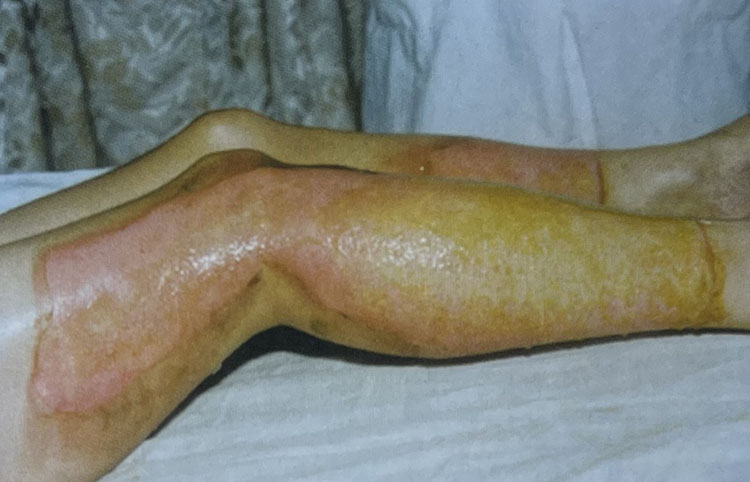 k8凯发官网(中国)天生赢家·一触即发