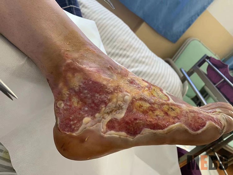 k8凯发官网(中国)天生赢家·一触即发